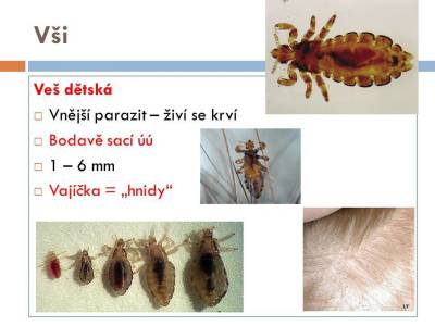 vsiplostice-02